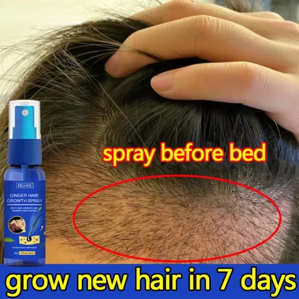 Hair Care Lotion - Schnelles Ingwer-Haarwuchsspray für Wurzelwachstum, Anti-Haarausfall, Haarwuchs-Serum,